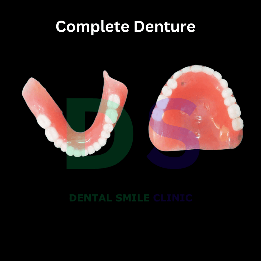 Complete denture.